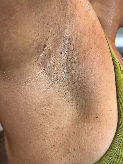 The armpit collection