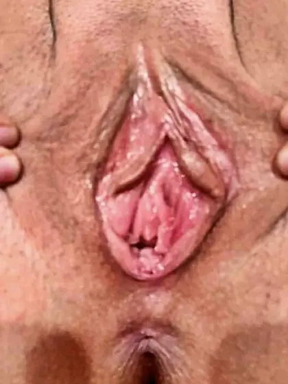 Bald Married Slut Spread Wide Full Body & Extreme