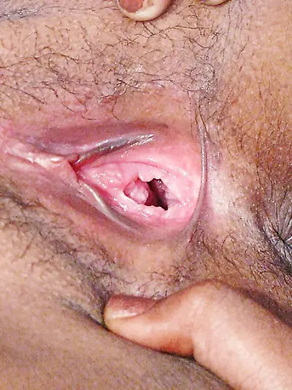 The Beauty of Indian Teen Anal Masturbation Lesbians