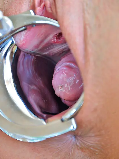 Brunette shows her pussy after fisting,  using her favorite specu