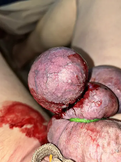 Castration of my manhood