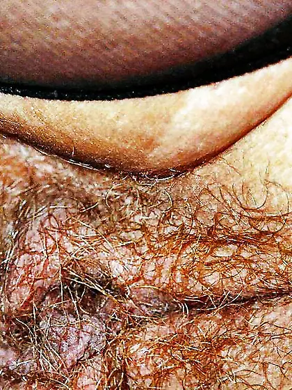 Fur Covered Urwaldmoesen