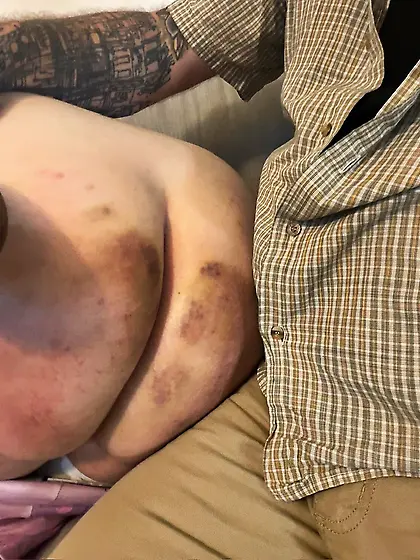 november 13 2025 spanked ass photos