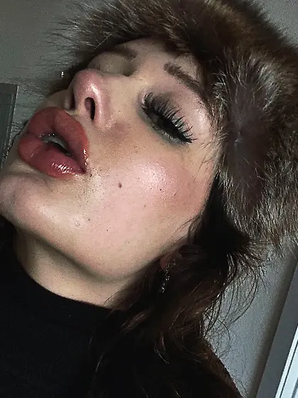 Braceface Bimbo With Juicy Puffed Up Lips