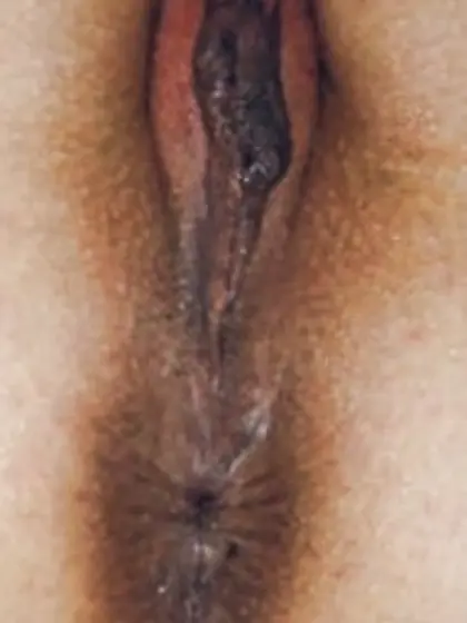 Before or After - competition no. 2