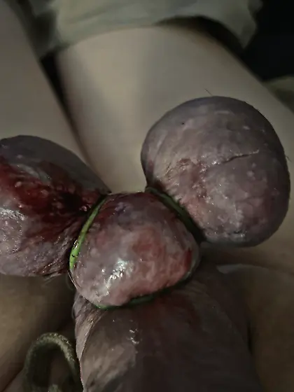 Castration of my manhood