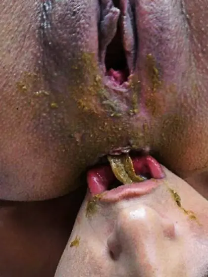 Scat vomit sluts