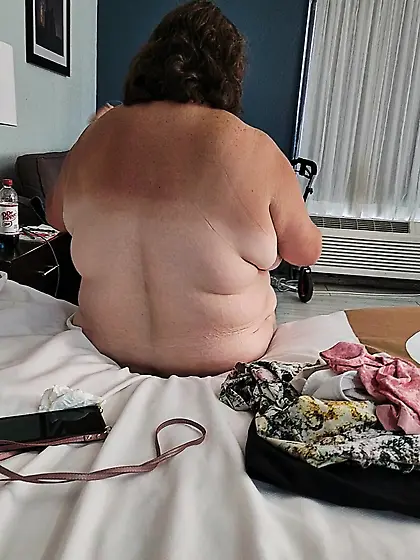 BBW Amputee wife in hotel naked with big tits