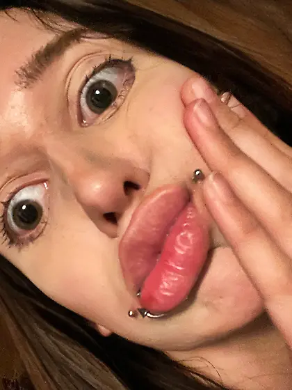 Braceface Bimbo With Juicy Puffed Up Lips