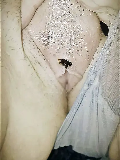 FGC and infibulation