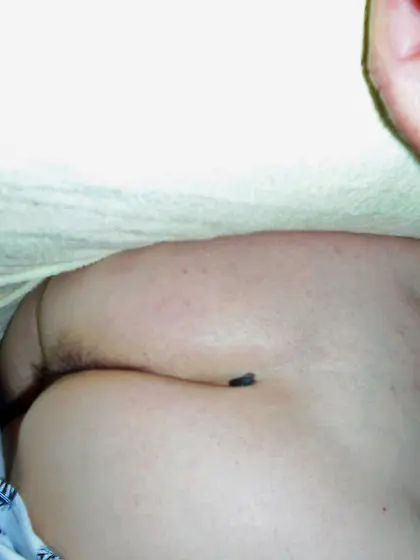 After a hard Day and they won't go away