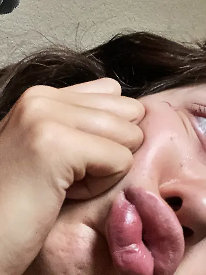 Braceface Bimbo With Juicy Puffed Up Lips