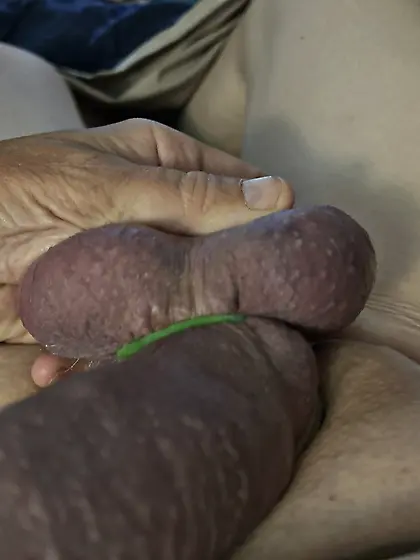 Castration of my manhood