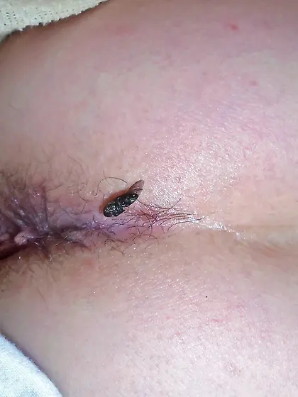 After a hard Day and they won't go away