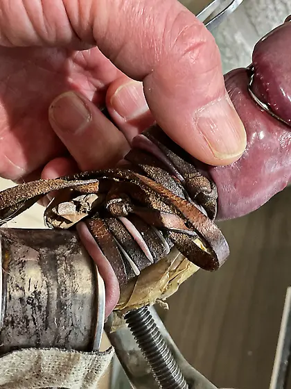 Estim ripping off papules from glans corona