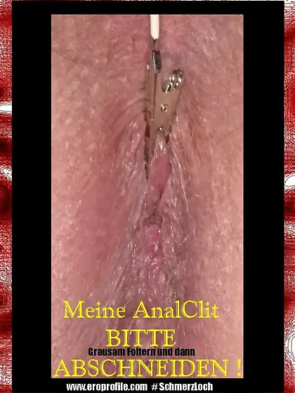 Analbeschneidung