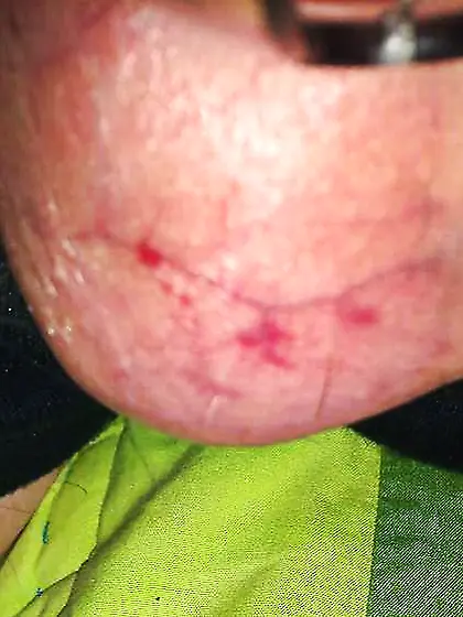 Chastity ball splattered