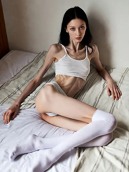 Skinny anorexic brunette girl on bed