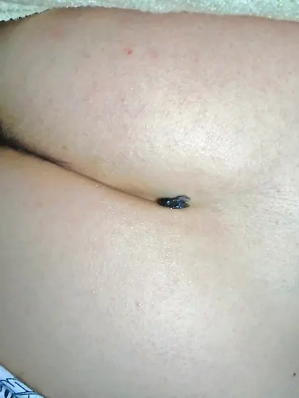 After a hard Day and they won't go away