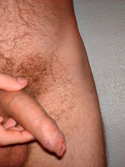 Legal teen uncut dick tight foreskin
