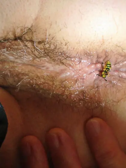 After a hard Day and they won't go away