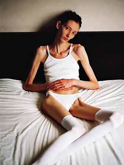 Skinny anorexic brunette girl on bed