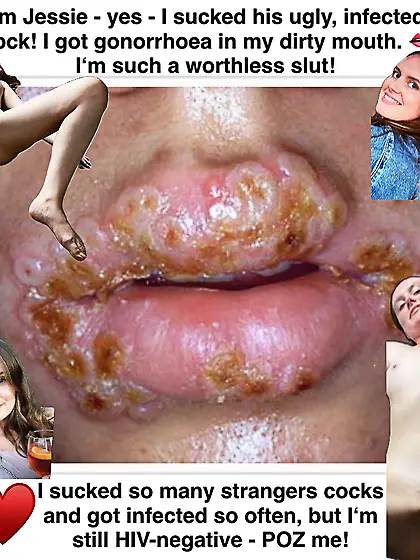 I got gonorrhoea after sucking his dirty cock!