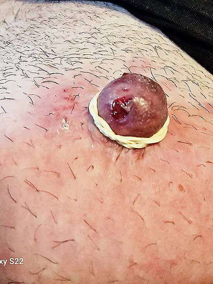 Elastic nipples first time