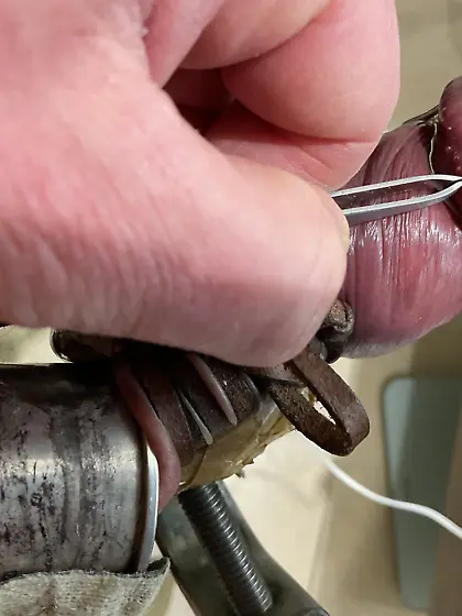 Estim ripping off papules from glans corona