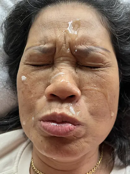 Asian Facial
