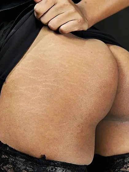 Nose pinched double blow