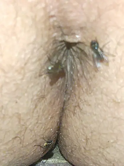 Flies on my anus in the village.  06. 2025