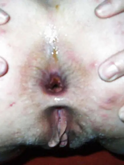 Mein Arsch von gestern