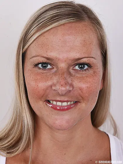 Female with freckled face ready to get naked and expose her hosp