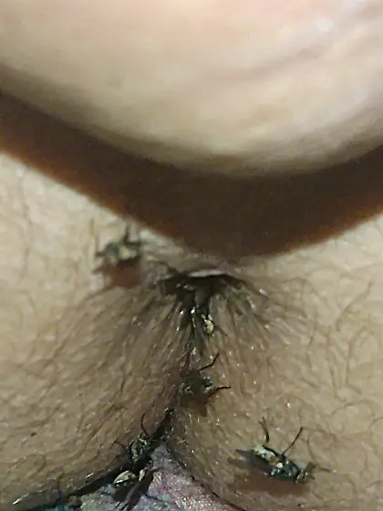 Flies on my anus in the village.  06. 2025