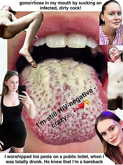 I got STD from sucking a cock in a public toilet!