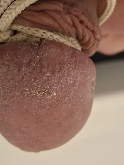 Schleifpapier Tag danach