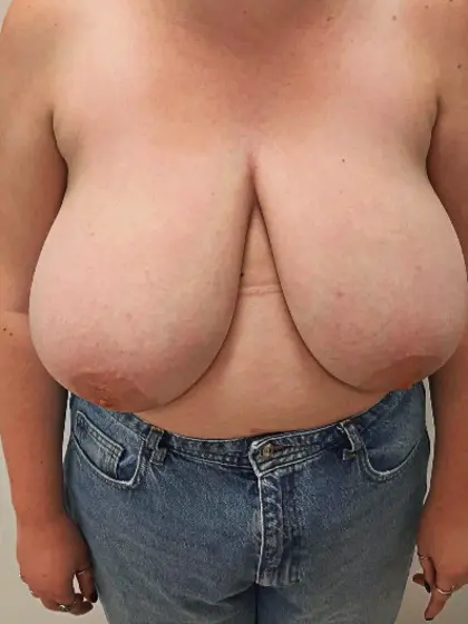 Athena - 23yr old,  34K boobs