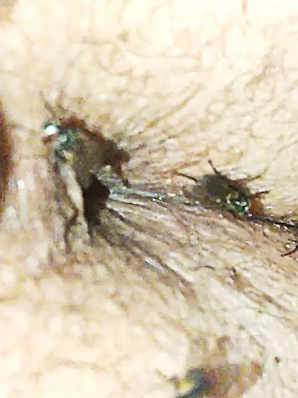 Flies on my anus in the village.  06. 2025