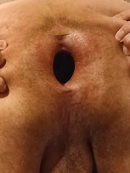 Asshole Gape