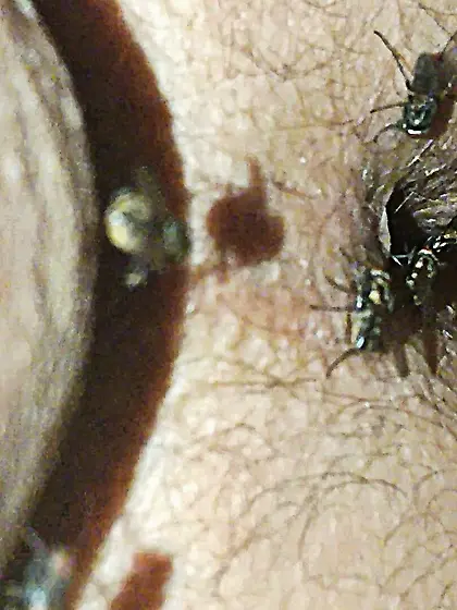 Flies on my anus in the village.  06. 2025
