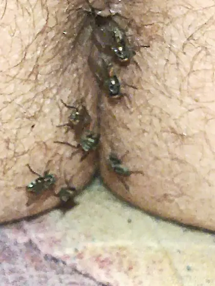Flies on my anus in the village.  06. 2025