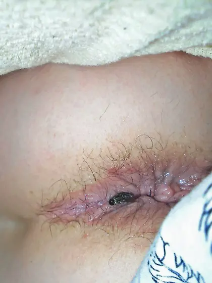 After a hard Day the bugs won't go away 2