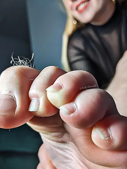 No Polish toes 11