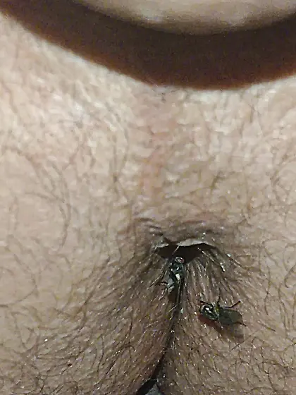 Flies on my anus in the village.  06. 2025