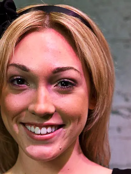 Rubber bands snap fair-skinned