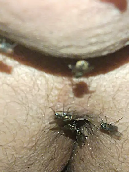 Flies on my anus in the village.  06. 2025