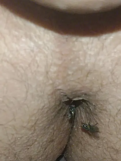 Flies on my anus in the village.  06. 2025