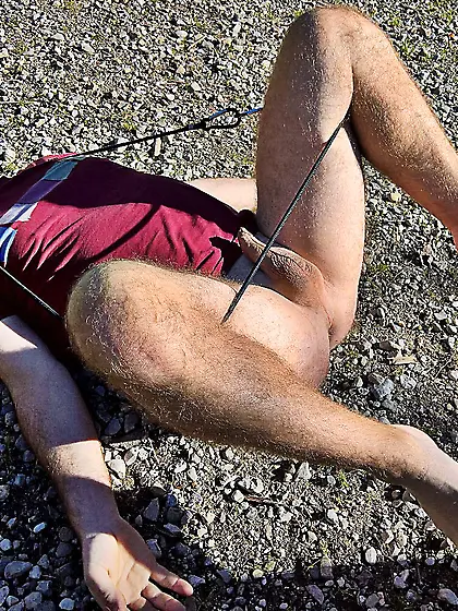 Andy sedated Gymnast 78