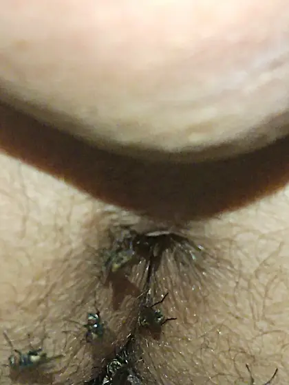 Flies on my anus in the village.  06. 2025